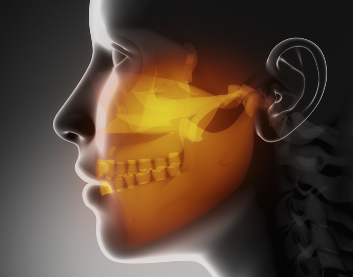 3d x-ray image of a person requiring jaw surgery